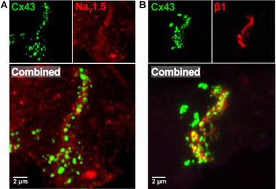 Intercalated Disk Extracellular Nanodomain Expansion in Patients With Atrial Fibrillation